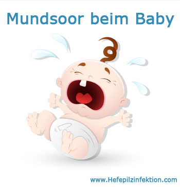 Soor im Mund beim Baby vermeiden