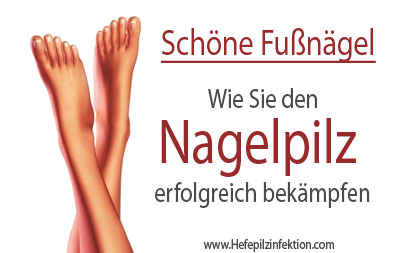 Schöne Fußnägel - Nagelpilz loswerden